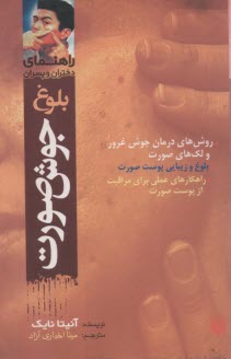 www.payane.ir - بلوغ، جوش صورت 